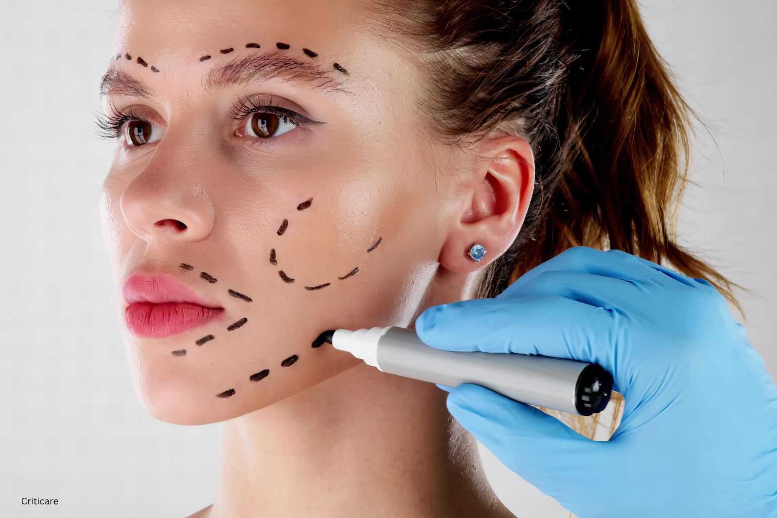 Plastic Surgery Care